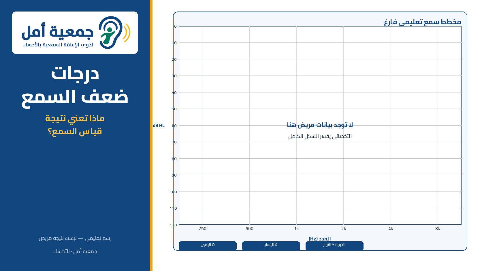 درجات ضعف السمع